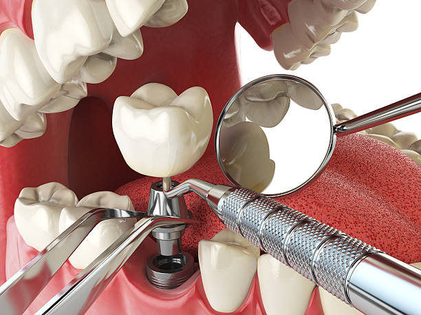 Best After-Hours Emergency Dentist in Waupaca, WI